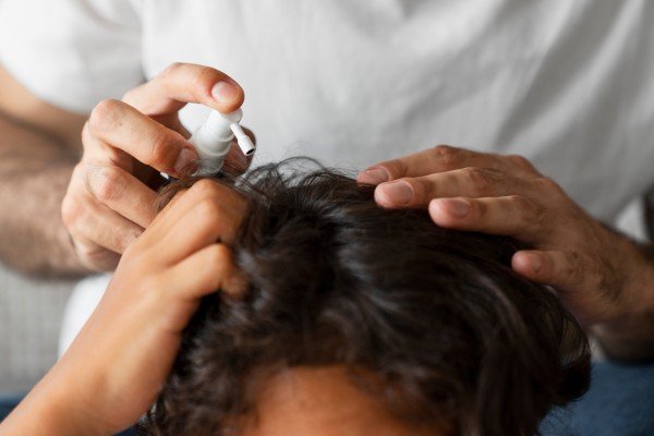 Homeopathy for Hair Fall in Sector 50 Faridabad: Causes, Treatment Options, and Tips for Healthy Hair